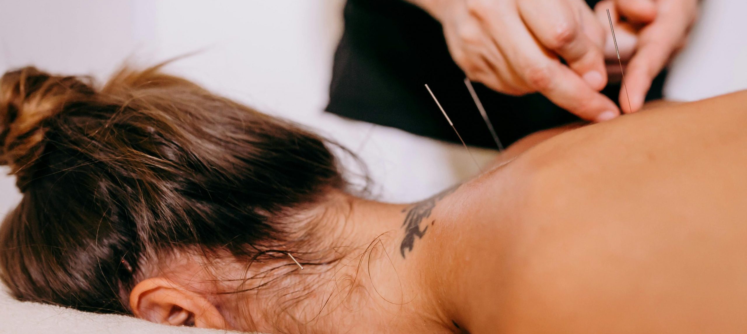 Acupuncture : Rééquilibrez votre Énergie